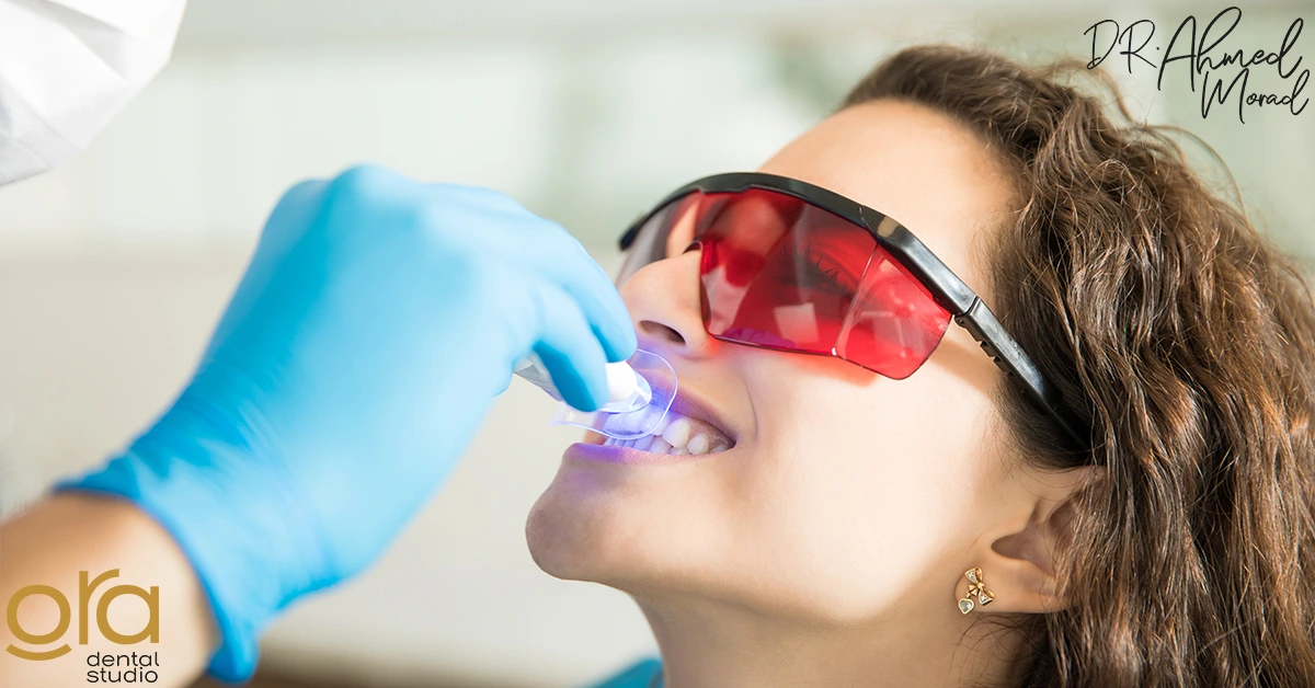 أنواع تبييض الأسنان وأسعارها
