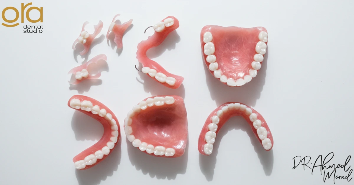 أسعار تركيبات الأسنان المتحركة