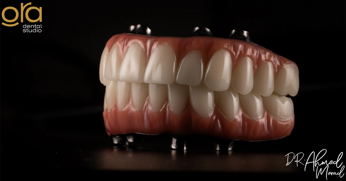 تركيبات الأسنان الثابتة وأسعارها