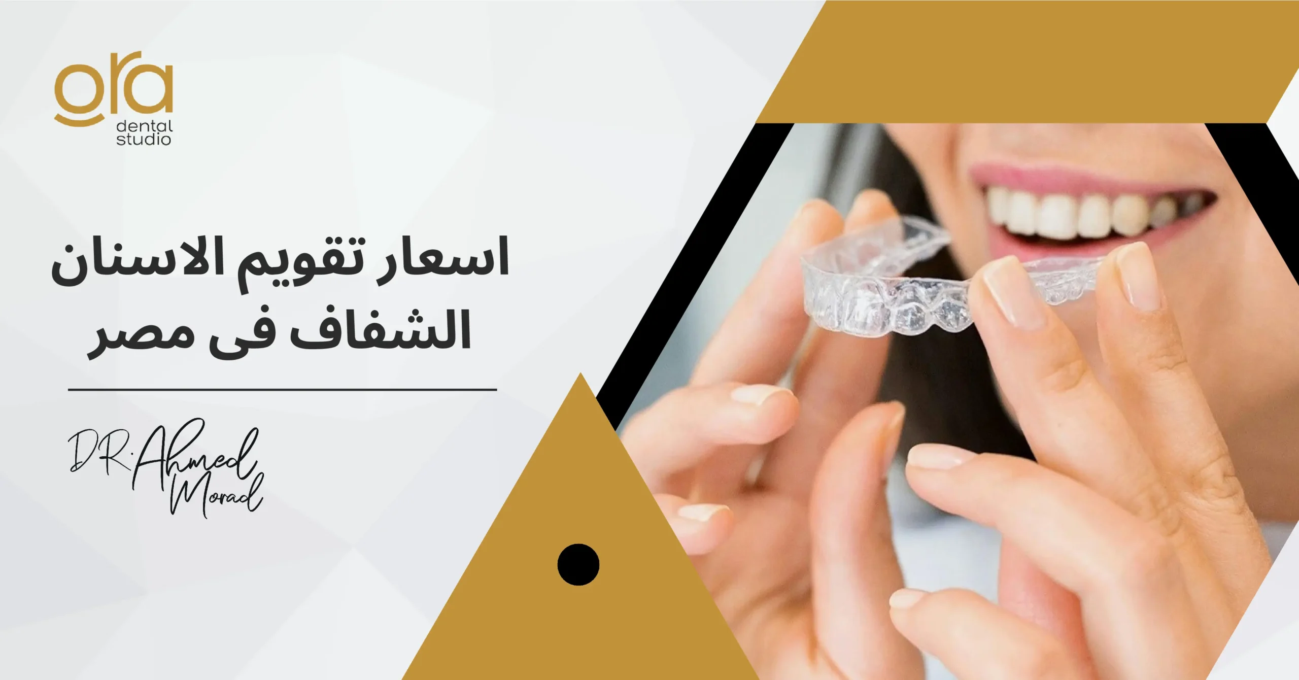 أسعار تقويم الأسنان الشفاف في مصر