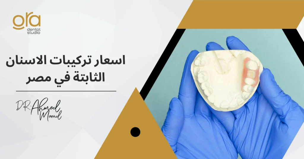 أسعار تركيبات الأسنان الثابتة في مصر image