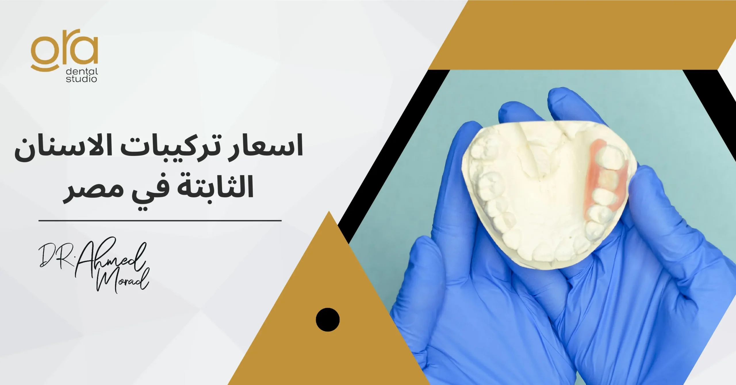 أسعار تركيبات الأسنان الثابتة في مصر