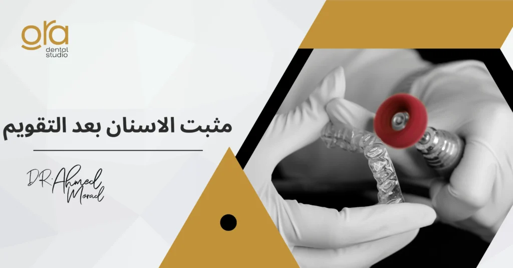 مثبت الأسنان بعد التقويم image