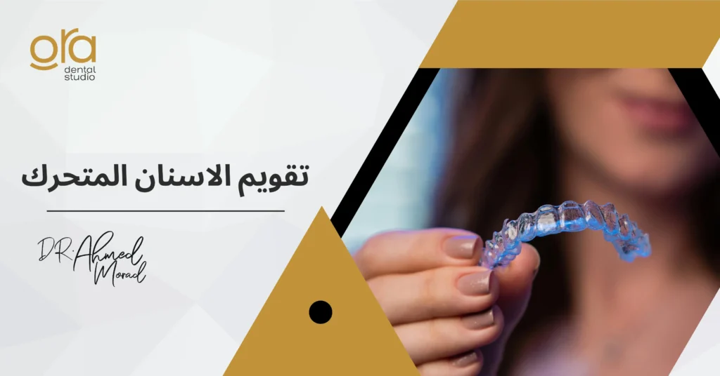 تقويم الأسنان المتحرك image