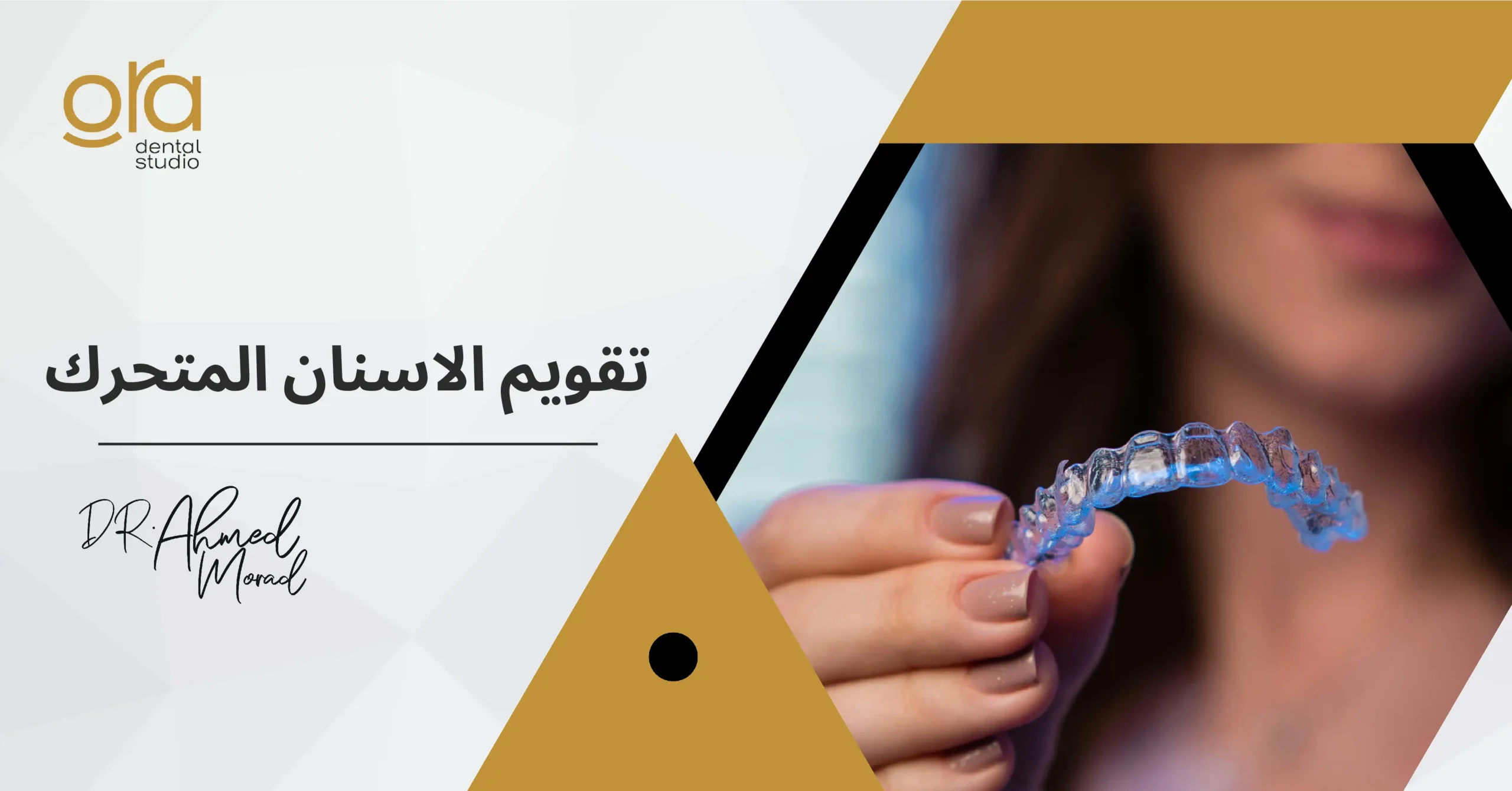 تقويم الأسنان المتحرك