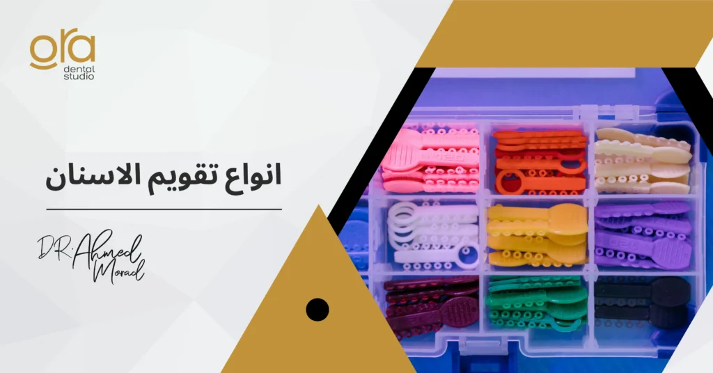 أنواع تقويم الأسنان image