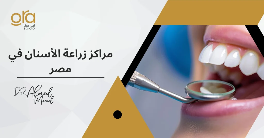 مراكز زراعة الأسنان في مصر image